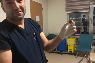 Ağrı’da yuttuğu ceviz yemek borusundan çıkarıldı