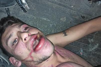 Antalya’da "Böcek yedirip dişlerimi kırdılar" iddiasına 20 yıl hapis talebi