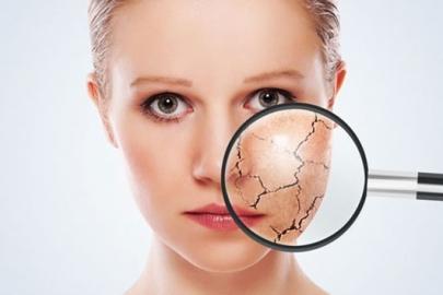 Cildiniz için kışa hazırlık reçetesi