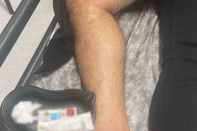 Marmaris’te silahlı kavga: 1 yaralı