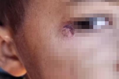 Öğrencinin yüzünde sigara söndüren temizlik görevlisi tutuklandı