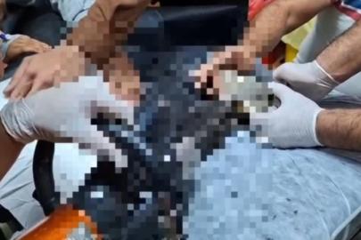 Tel Abyad’ta elini kıyma makinesine kaptıran çocuk Şanlıurfa’da tedavi altına alındı