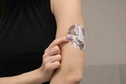 Diyabet tedavisinde yapay zeka destekli teknolojilerle "Yapay Pankreas" dönemi başlıyor