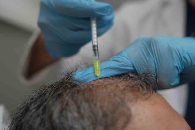 Dökülen saçlar vücudun bir alarmı olabilir