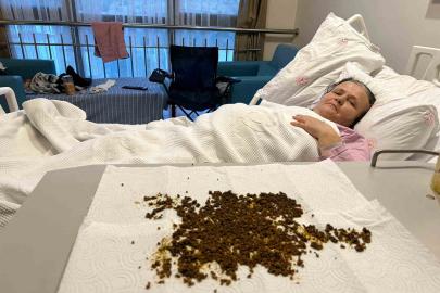 Hastadan çıkan taşları sayamadılar