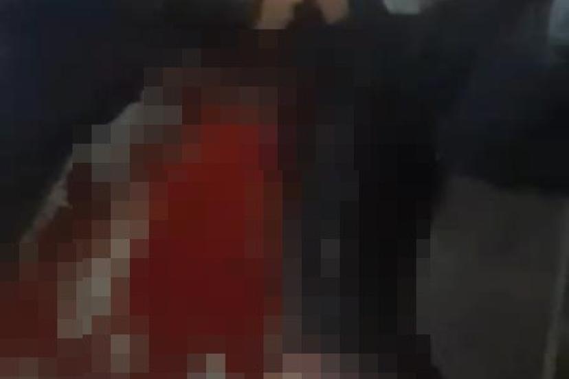 Üsküdar’da bıçaklı kavga : 1 yaralı