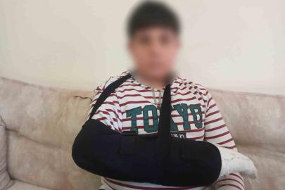 Ankara’da ortaokul öğrencisi, kendisinden 3 yaş küçük öğrencinin parmağını kırdı