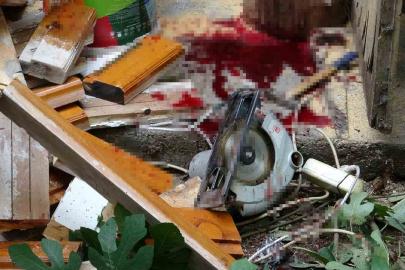 Bacağını elektrikli testereye kaptıran yaşlı adam ağır yaralandı, olayı haber alan torun gözyaşlarına boğuldu