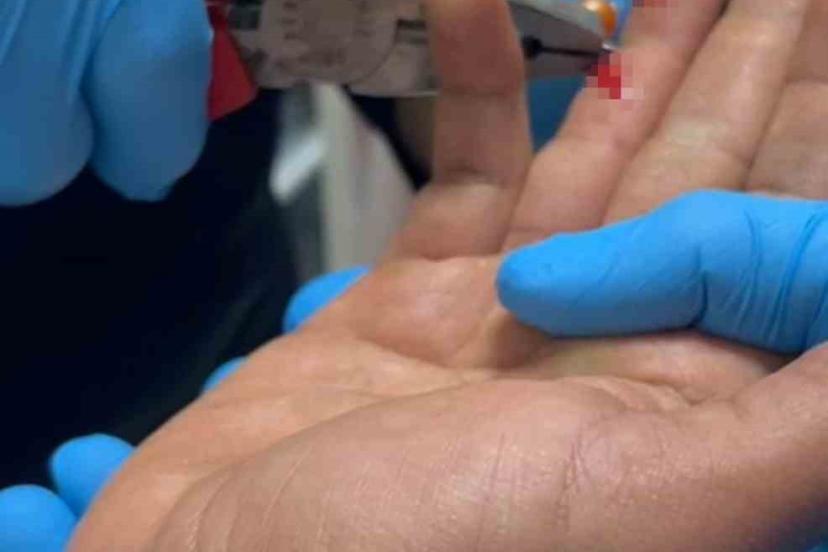 Balık macerası hastanede bitti: Parmağına saplanan olta iğnesini itfaiye çıkarttı