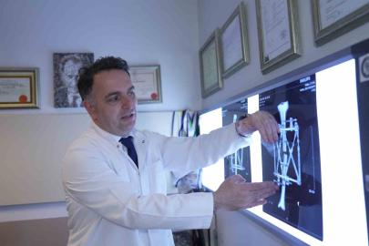 Boy kısalığına karşı modern çözüm: kemik uzatma yöntemleri