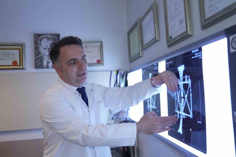 Boy kısalığına karşı modern çözüm: kemik uzatma yöntemleri