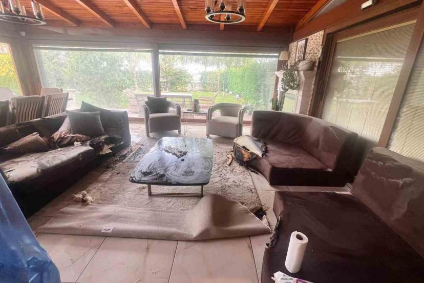 Dekoratif şömine bomba gibi patladı, vücudunun yüzde 30’u yandı: "Alev alev yanıyordum"