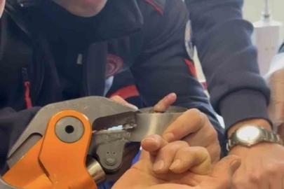 Parmağı çelik küllüğe sıkışan bebeğin imdadına itfaiye yetişti