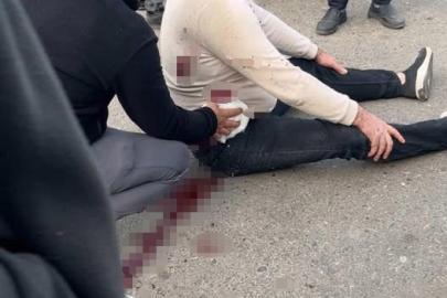 Şanlıurfa’da bıçaklı kavga: 1 yaralı