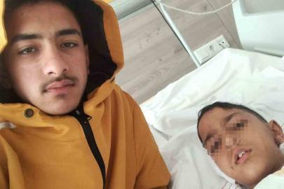 Ankara’da sokak köpeğinin saldırısına uğrayan çocuk yaralandı