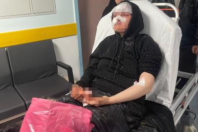 Boşanmak isteyen kadın eşi tarafından öldüresiye darp edildi