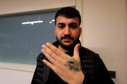 Dövme sildirmek isterken kabusu yaşadı, elindeki dokular öldü