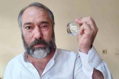 ‘Küfürlü konuşmayın’ diye uyardı, gözünden oldu