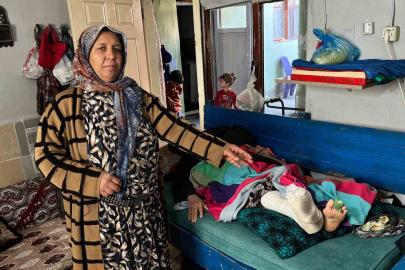 Evini su bastı, kurtulmaya çalışırken düşüp ayağını kırdı