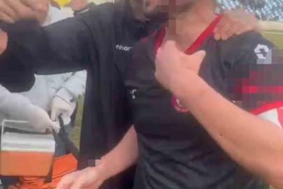 Maç sonu saha karıştı: 3 futbolcu yaralandı