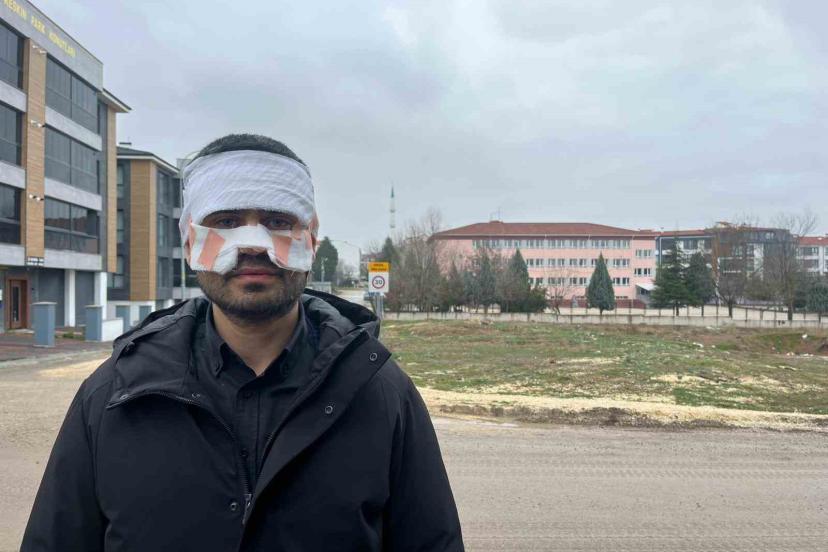 Rehber öğretmenin yüzüne sıcak çay fırlattığı fizik öğretmeni feci şekilde yandı