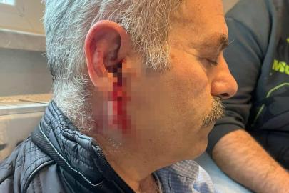 Silivri’de özel bakım merkezine çağrılan eski çalışan darbedildi