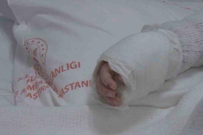 Üzerine kaynar su dökülen bebeğin vücudunun yüzde 27’si yandı