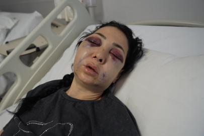 Anne ve oğlunun darp edilmesine ilişkin gözaltına alınan 3 şüpheliden 1’i tutuklandı