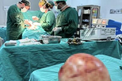 Van’da bir kadının karnından 35 santimetrelik dev kitle çıkarıldı