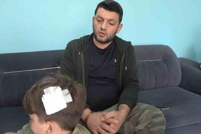 Yalova’daki komşu kavgasında bu kez 8 yaşındaki çocuğa taşlı saldırı