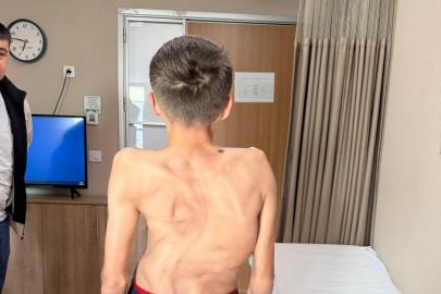 Kırgızistanlı genç şifayı Türk hekimlerinde buldu