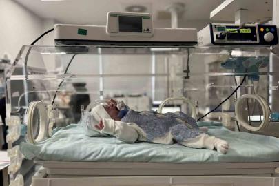 Mardin’de nadir görülen hastalıkla doğan bebek sağlığına kavuştu