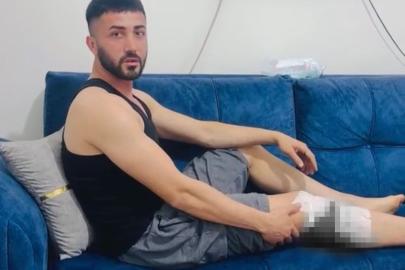 Nizip’te başıboş köpek saldırısında yaralanan 2 kişi belediyeye tepki gösterdi