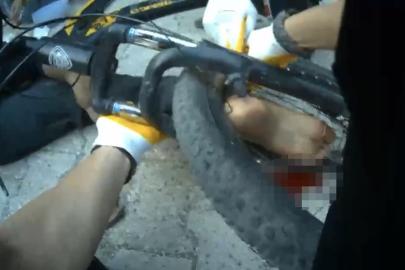 Osmaniye’de ayağı bisikletin tekerine sıkışan çocuk ekiplerce kurtarıldı