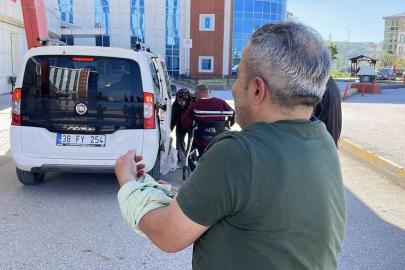 Sivas’ta acemi kasaplar hastanenin yolunu tuttu