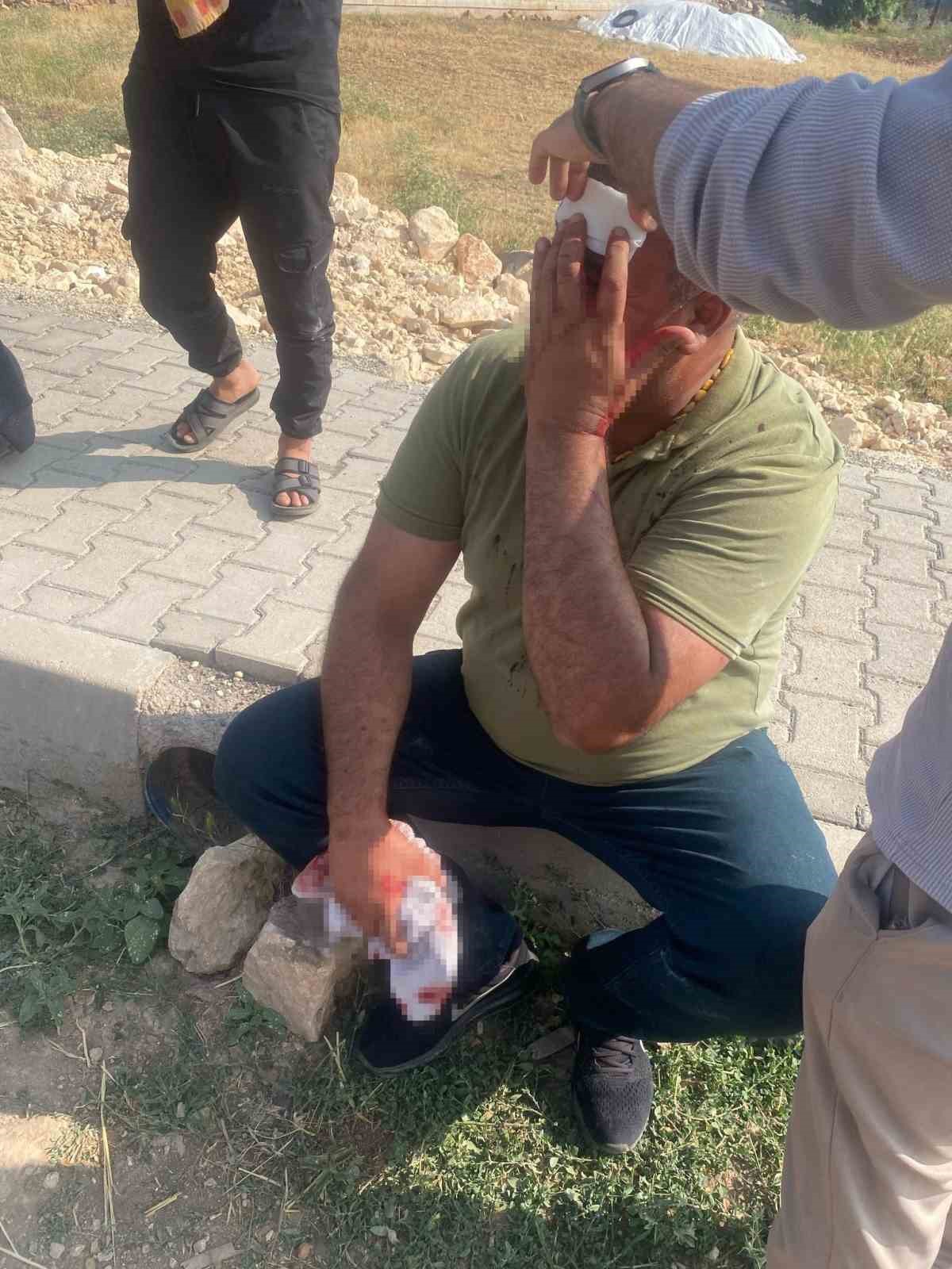 Şanlıurfa’da çocukların kavgasına büyükler karıştı: 5 yaralı